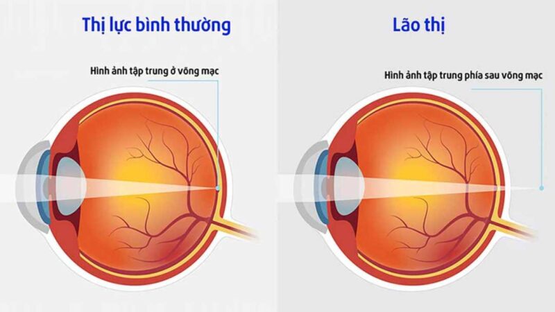 Mua kính lão cho người già ở đâu? Giá kính lão cho người già 2